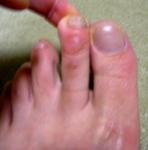 webなおち足の悩み.jpg webなおち足の悩み.jpg